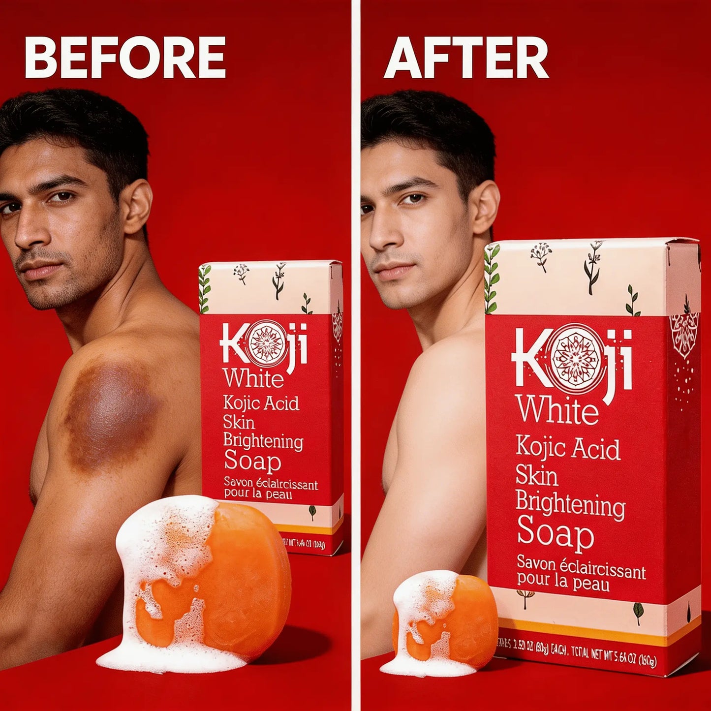 Kojic Acid Soap for Dark Spots & Skin Brightening UAE - BeautywithDreams